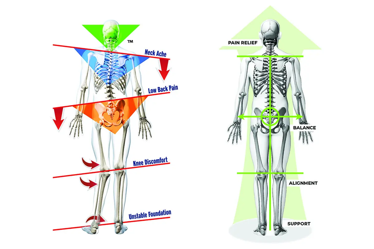 Orthotics